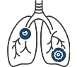 IVC Filters Image